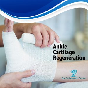 ankle cartilage regeneration