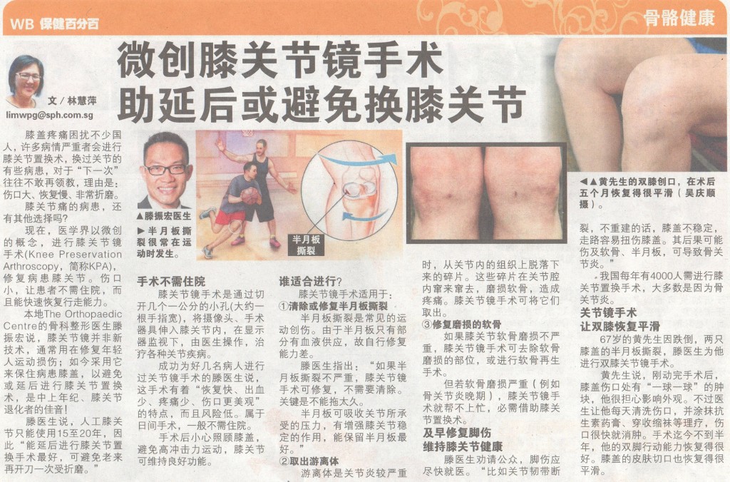 Knee Arthroscopy Alternative to Knee Replacement Surgery